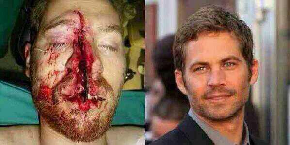 Paul-walker-Faced-After-Crash-31