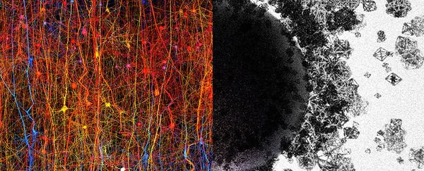 brain algebraic topology frontiers 1024