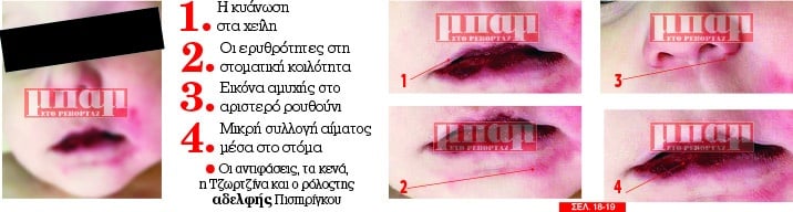 Ίριδας