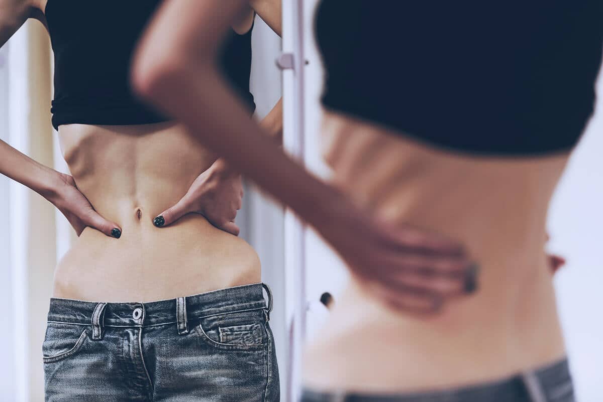 «Anorexia»