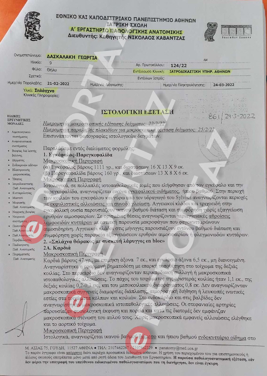 Τζωρτζίνας